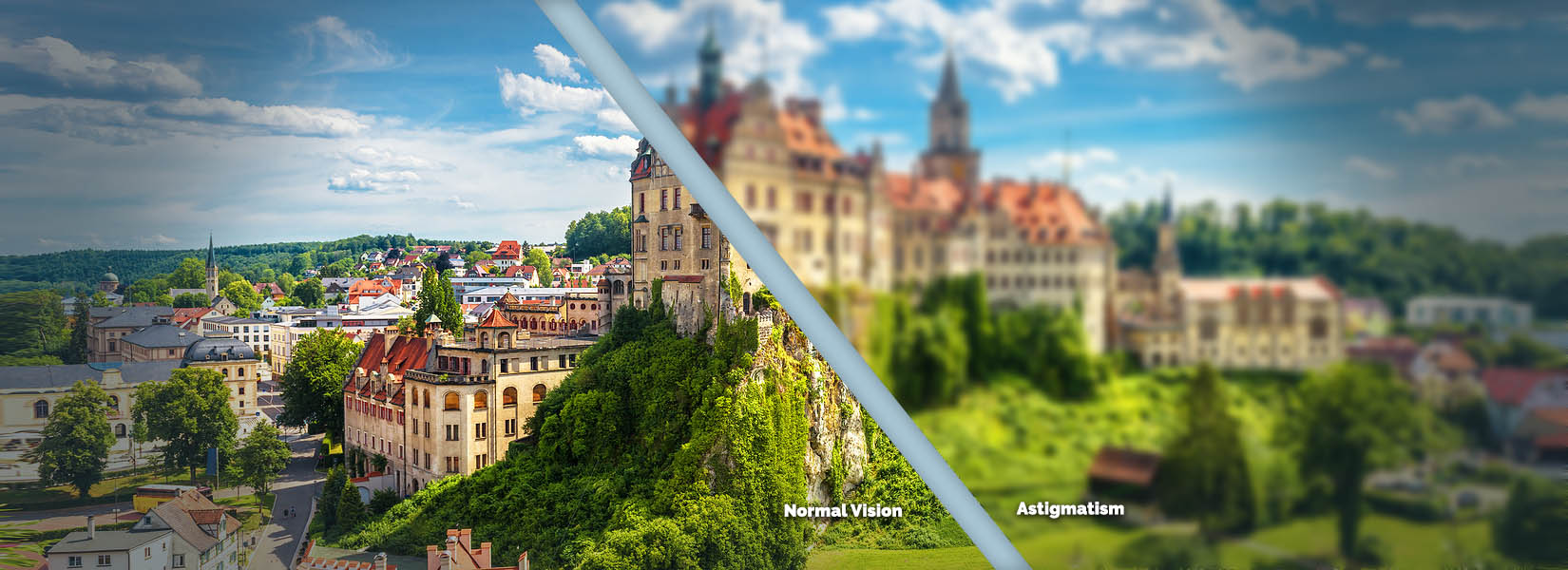 Astigmatism Treatment in Bethany